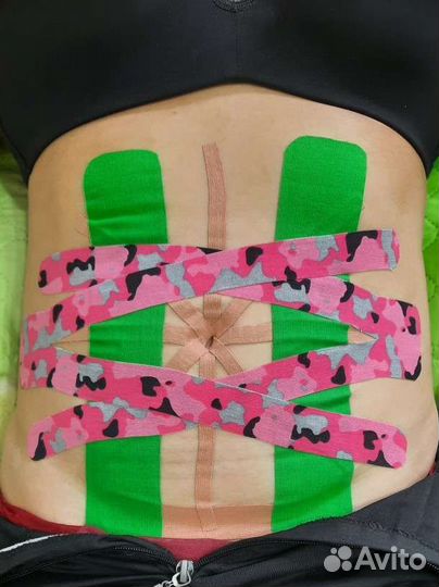 Тейпирование