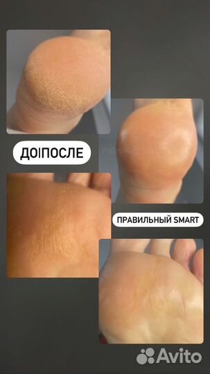 Смарт педикюр обучение