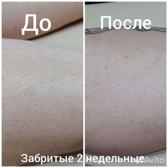 Восковая Депиляция