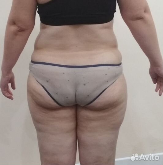 Услуги массажиста