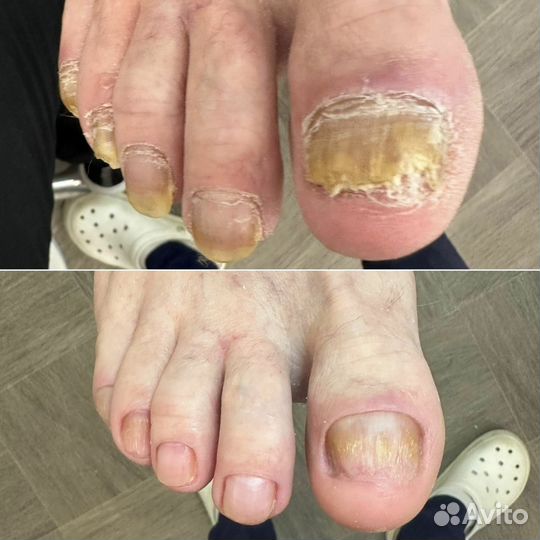 Подолог с медицинским образованием