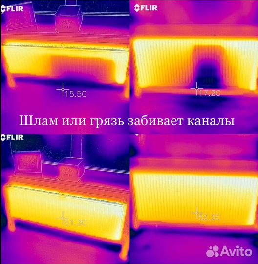Обследование тепловизором