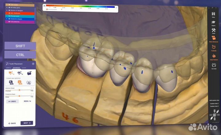 Hyperdent/3shape/ExoCad/Biblioteki Geo/PlastyCad