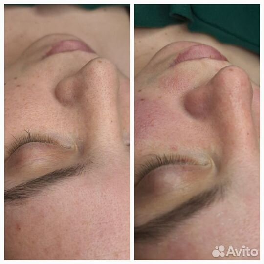 Коррекция фигуры. Массаж. Лазерная эпиляция