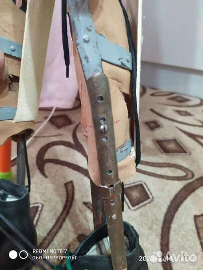 Аппарат на всю ногу