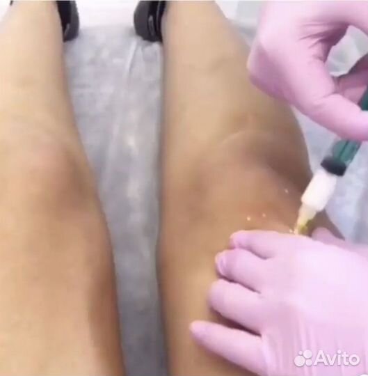 Липолитик, точка голода