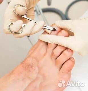 Подолог. Проблемные ногти. Выезд на дом