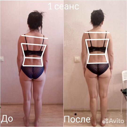 Профессиональный оздоровительный массаж