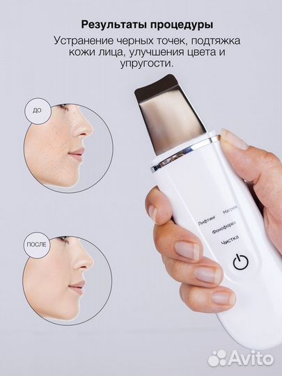 Ультразвуковой аппарат для чистки лица 3в1 оптом