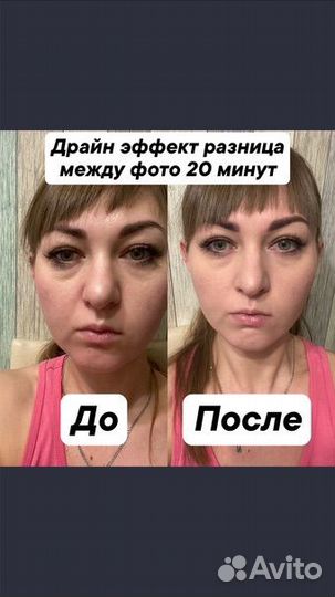 Drainage-дренаж снятие отечности