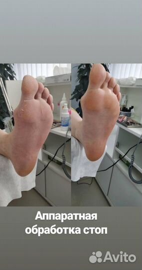 Мужской и женский педикюр smart