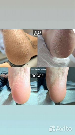 Маникюр педикюр