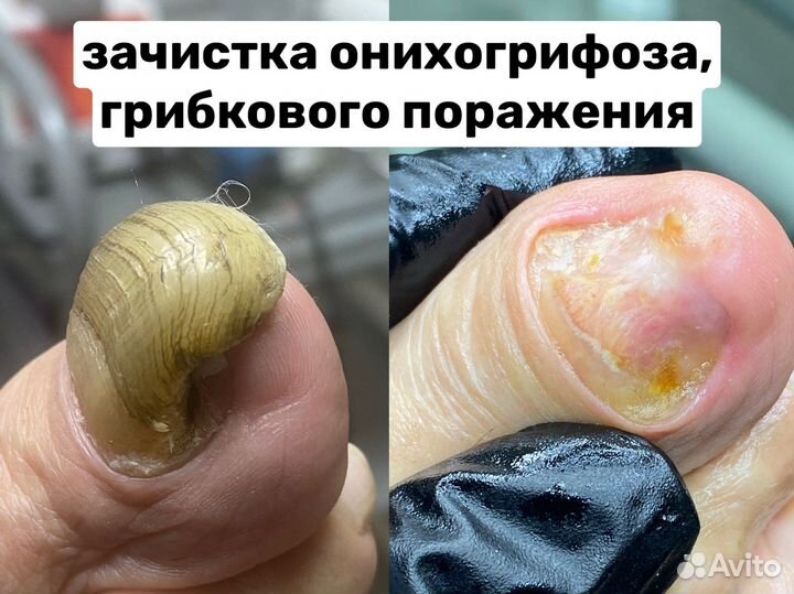 Мастер педикюра, подолог, Люберцы, Жулебино