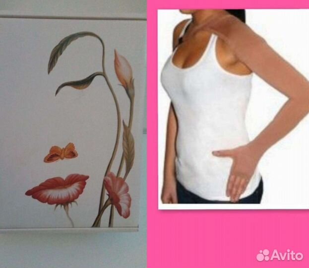 Экзопротез У-6 и рукав компрессионный