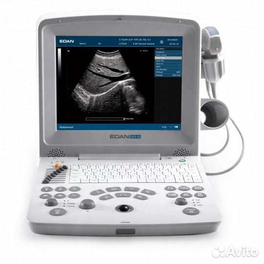 Узи аппарат Edan Dus 60