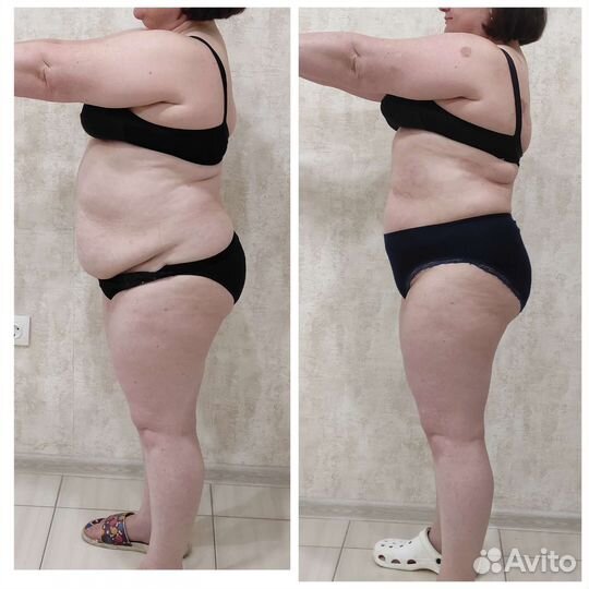 Антицеллюлитный и коррекция фигуры массаж