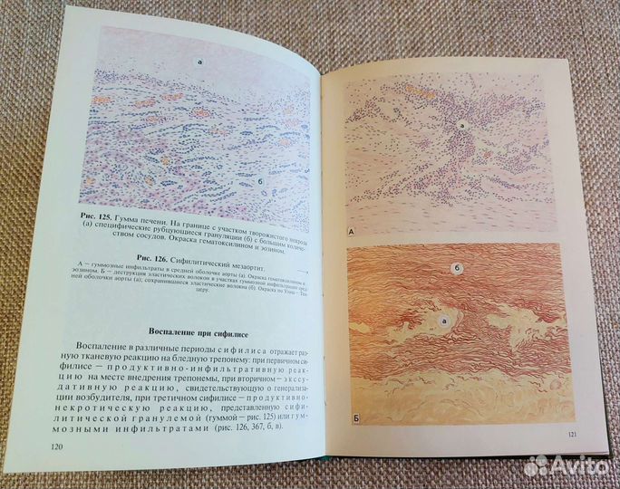 Атлас по патологической анатомии