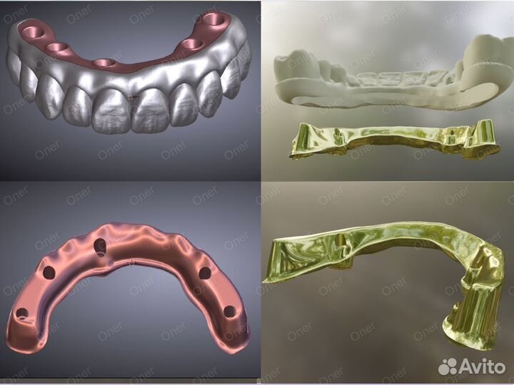 Blender for Dental (B4D) iBar балки и все модули