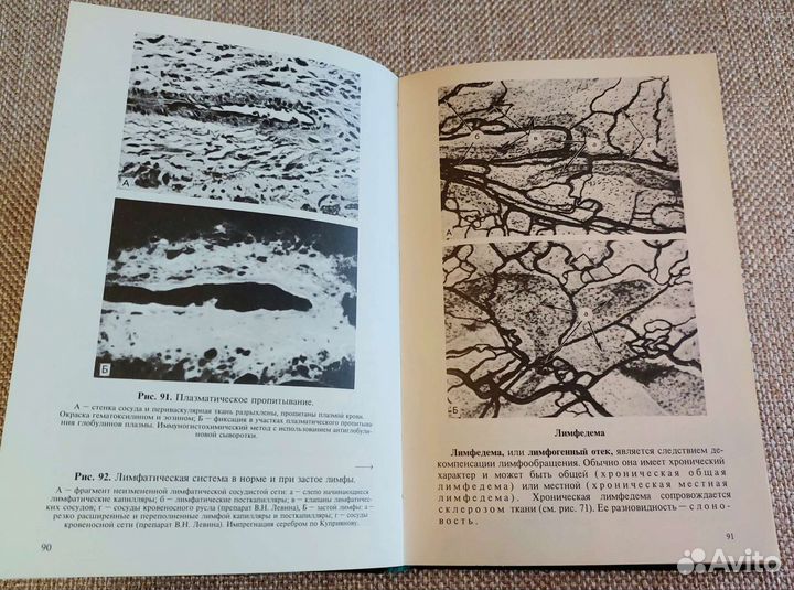 Атлас по патологической анатомии