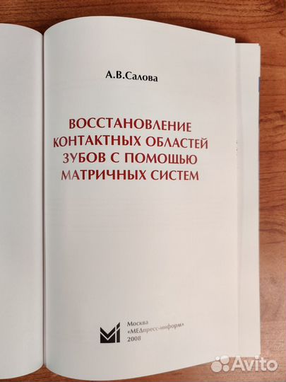 Восстановление контактных областей зубов - Салова