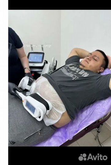 Криолиполиз