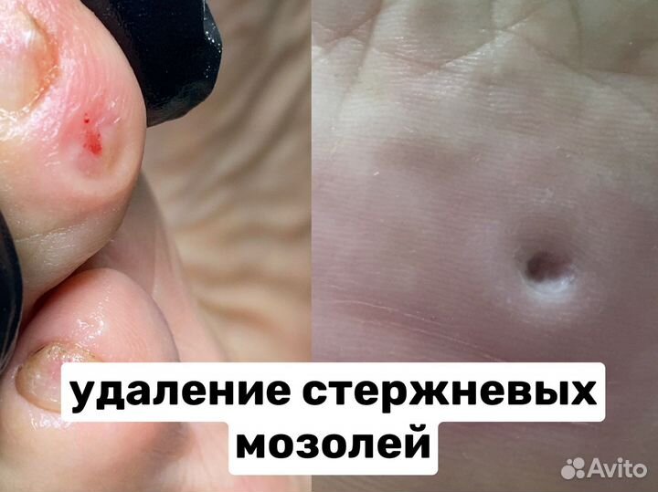 Мастер педикюра, подолог, Люберцы, Жулебино