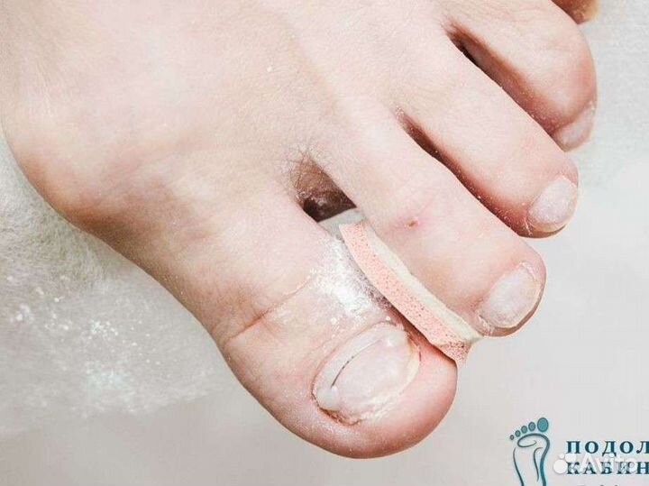 Подолог. Медицинский педикюр