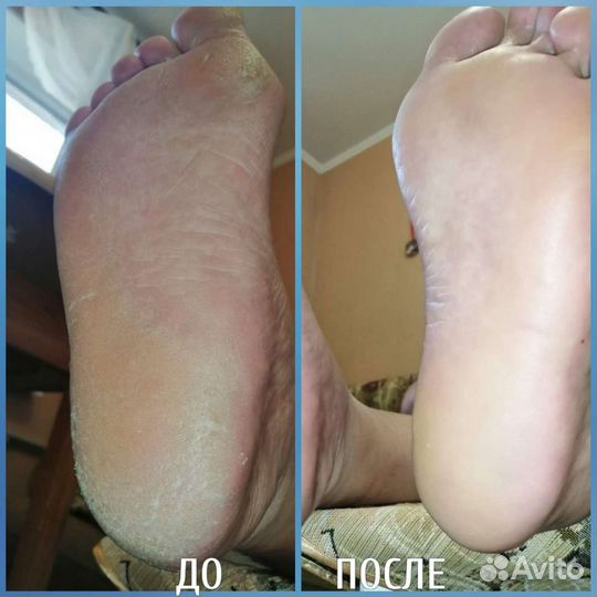 Мастер педикюра