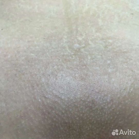 Восковая депиляция,шугаринг