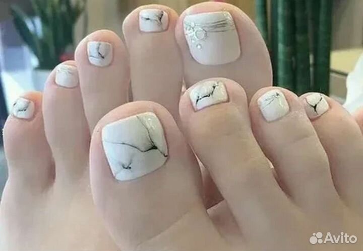 Педикюр Титановая нить Онихолизис Вросший ноготь