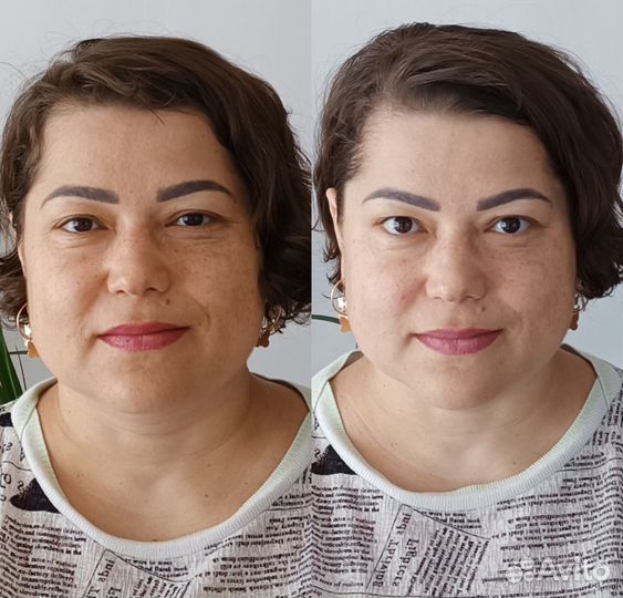 Массаж лица