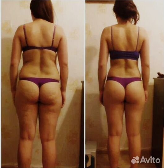 Ручной массаж, LPG, SPA, Крио,9D скульптор