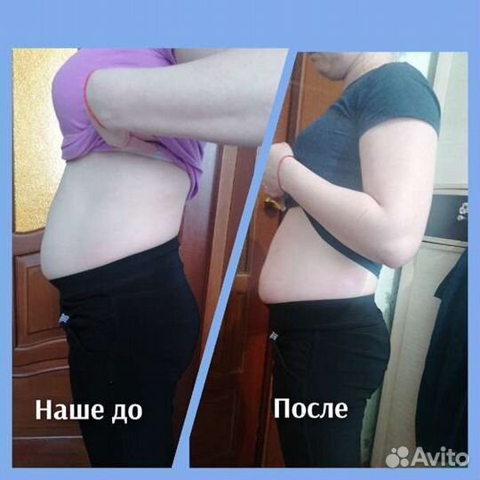 Антицеллюлитный массаж