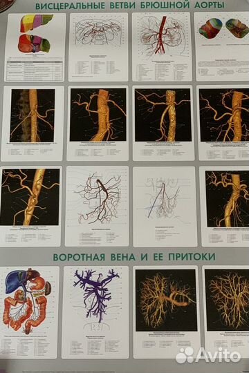 Медицинские плакаты