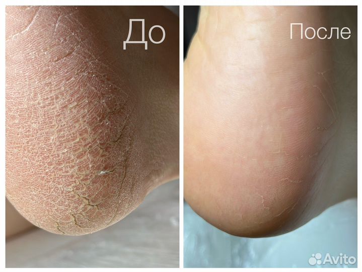 Маникюр гель лак. Наращивание