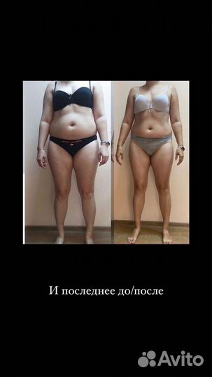 Антицеллюлитный массаж