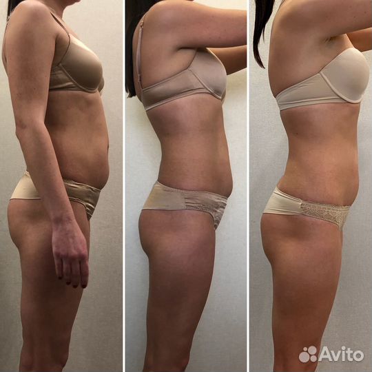 Массаж сферами