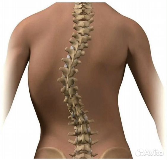 Главный Костоправ Грыжа Сколиоз Лордоз позвоноч