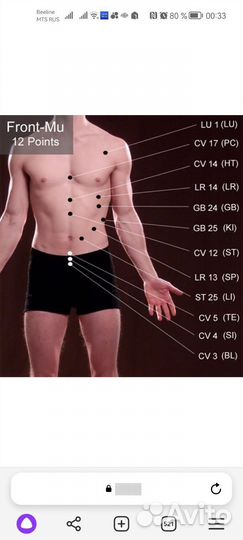 Иглотерапия, кетгут терапия, точки голода