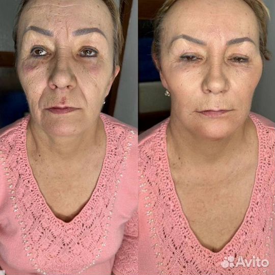 Лицо под ключ (фул фейс). Косметолог