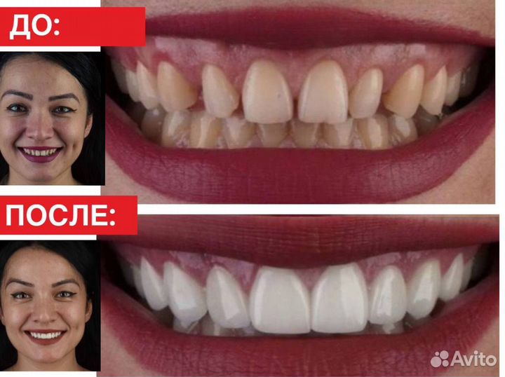 Зубной тур в Турцию. Улыбка мечты за 5 дней