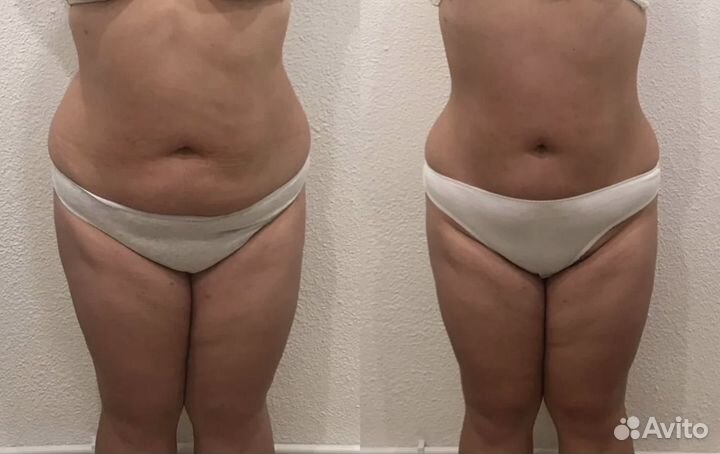 Массаж коррекция фигуры