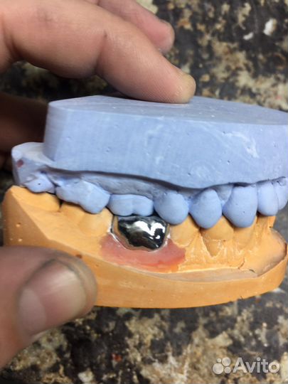 Зубной техник