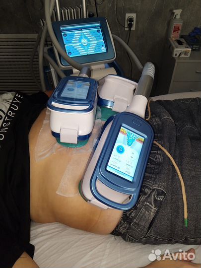 Криолиполиз