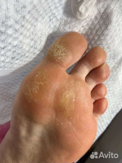 Смарт педикюр