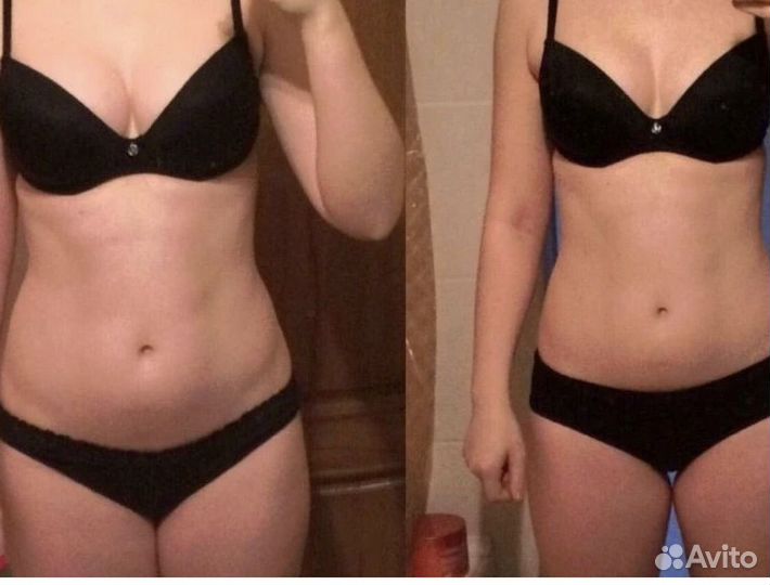 Антицелюлитный массаж