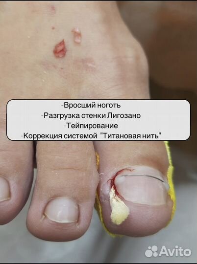 Подолог. Воронеж