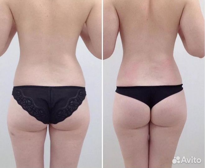 Нужны модели на массаж