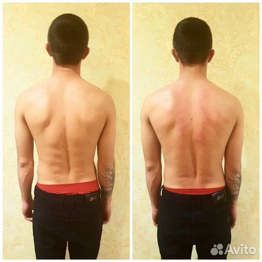 Профессиональный массаж