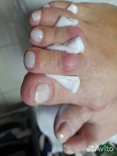 Педикюр любой сложности